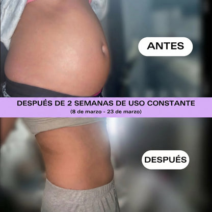 Una dosis para la hinchazón