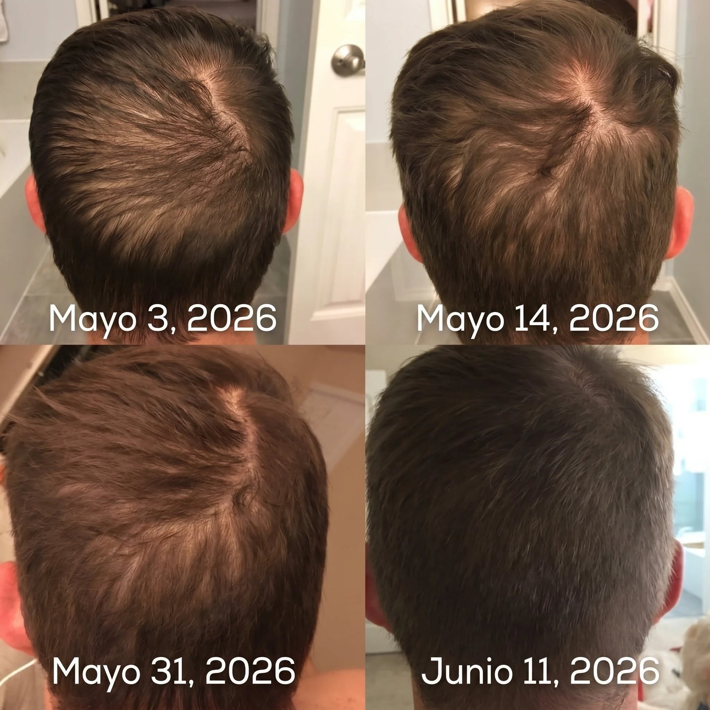 Ossea™ Shampoo Anticaída y Crecimiento