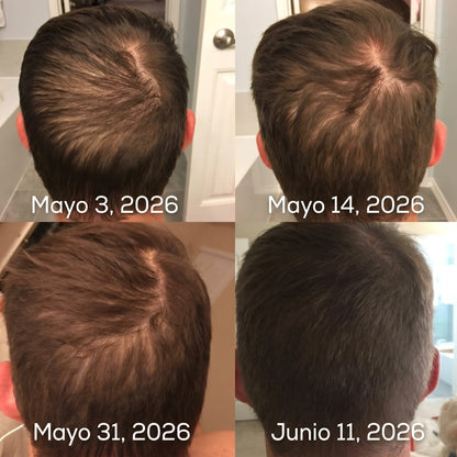 Ossea™ Shampoo Anticaída y Crecimiento